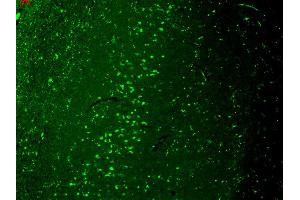 Immunohistochemistry analysis using Mouse Anti-TrpV3 Monoclonal Antibody, Clone S15-4 .