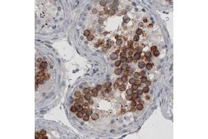 Immunohistochemical staining (Formalin-fixed paraffin-embedded sections) of human testis with LY6K monoclonal antibody, clone CL2433  shows strong cytoplasmic immunoreactivity in a subset of cells in seminiferous tubules. (Ly6k anticorps)