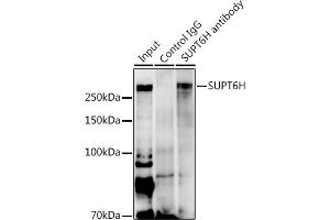 Immunoprecipitation analysis of 600 μg extracts of Mouse heart using 3 μg SUPT6H antibody (ABIN7270645). (Spt6 anticorps  (AA 1500-1726))