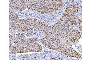 IHC analysis of TP53 using anti-TP53 antibody (ABIN7599050).