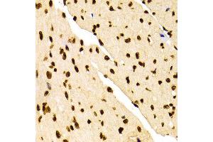 Immunohistochemistry of paraffin-embedded Mouse heart using H3K27me2 antibody at dilution of 1:100 (x400 lens).