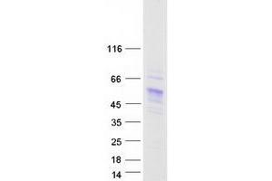 Validation with Western Blot