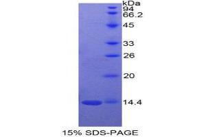 SDS-PAGE (SDS) image for Sema Domain, Immunoglobulin Domain (Ig), Short Basic Domain, Secreted, (Semaphorin) 3A (SEMA3A) (AA 580-664) protein (His tag) (ABIN1171330) (SEMA3A Protein (AA 580-664) (His tag))