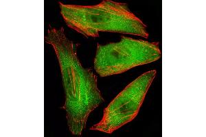 Fluorescent image of Hela cells stained with CFL2 Antibody (C-term) (ABIN6243137 and ABIN6577407).