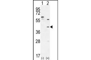 Western blot analysis of TGIF1 (arrow) using rabbit polyclonal TGIF1 Antibody (Center ) (ABIN656000 and ABIN2845379). (TGIF1 anticorps  (AA 145-174))