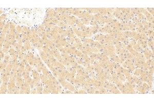 Detection of ST2 in Human Liver Tissue using Polyclonal Antibody to Syntenin 2 (ST2) (SDCBP2 anticorps  (AA 1-292))
