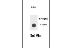 Dot Blot (DB) image for anti-Colony Stimulating Factor 2 Receptor, Beta (CSF2RB) (pTyr766) antibody (ABIN3001760)