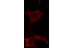ABIN6275152 staining Hela cells by IF/ICC.