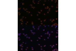 anti-Chitinase 3-Like 1 (Cartilage Glycoprotein-39) (CHI3L1) (AA 22-240) antibody