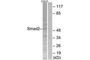 Western blot analysis of extracts from COLO205 cells, treated with serum 20% 15', using Smad2 (Ab-250) Antibody.