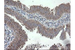 Image no. 7 for anti-Prefoldin Subunit 3 (PFDN3) antibody (ABIN1501702)