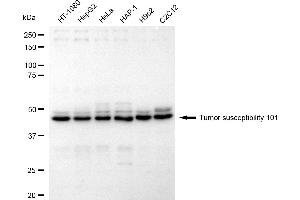 Western blotting analysis using Tumor susceptibility 101 antibody (ABIN7800697).