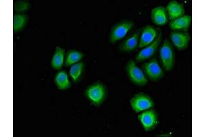 Immunofluorescent analysis of A549 cells using ABIN7142222 at dilution of 1:100 and Alexa Fluor 488-congugated AffiniPure Goat Anti-Rabbit IgG(H+L)