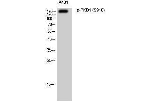 Western Blotting (WB) image for anti-Polycystic Kidney Disease 1 (Autosomal Dominant) (PKD1) (pSer910) antibody (ABIN3182229)