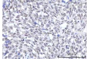 IHC analysis of RBM22 using anti-RBM22 antibody (ABIN7600268). (RBM22 anticorps  (AA 17-406))