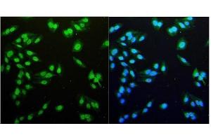 IF analysis of NDC80 using anti-NDC80 antibody (ABIN7602585). (NDC80 anticorps  (AA 87-602))