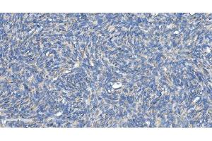 IHC analysis of DRP1/DNM1L using anti-DRP1/DNM1L antibody (ABIN7602180). (Dynamin 1-Like anticorps  (AA 618-736))