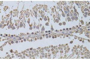 Immunohistochemistry of paraffin-embedded Rat testis using P2RY2 Polyclonal Antibody at dilution of 1:100 (40x lens). (P2RY2 anticorps)