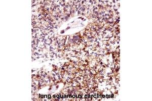 Immunohistochemistry (IHC) image for anti-Epithelial Cell Transforming Sequence 2 Oncogene (ECT2) antibody (ABIN2998212) (ECT2 anticorps)