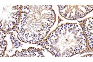Detection of LDHB in Rat Testis Tissue using Polyclonal Antibody to Lactate Dehydrogenase B (LDHB)