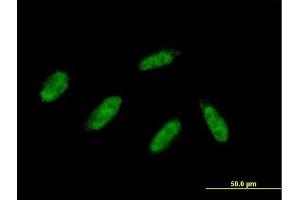 Immunofluorescence of purified MaxPab antibody to ZMYND11 on HepG2 cell.