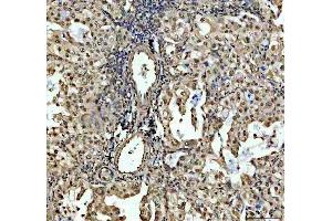 IHC analysis of SP6 using anti-SP6 antibody (ABIN5692945). (SP6 anticorps)