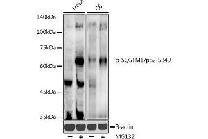 Western blot analysis of extracts of various cell lines, using Phospho-SQSTM1/p62-S349 antibody (ABIN7270206) at 1:500 dilution.