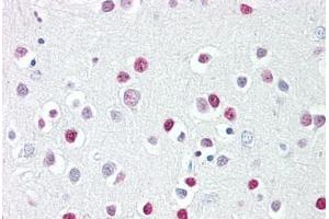 Anti-GATA4 antibody IHC staining of human brain, cortex. (GATA4 anticorps  (AA 330-380))