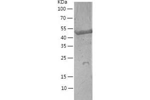 Western Blotting (WB) image for FK506 Binding Protein 5 (FKBP5) (AA 1-457) protein (His-IF2DI Tag) (ABIN7122977)