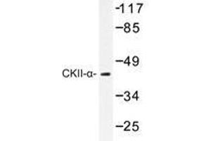 Western blot analysis of CKII-α antibody in extracts from HeLa cells. (CSNK2A1/CK II alpha anticorps)