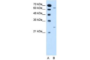 NAT2 antibody used at 2. (NAT2 anticorps)