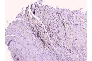 IHC analysis of TNFRSF11B using anti-TNFRSF11B antibody (ABIN7600875).