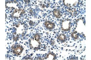 GUSB antibody was used for immunohistochemistry at a concentration of 4-8 ug/ml to stain Alveolar cells (arrows) in Human Lung. (Glucuronidase beta anticorps  (C-Term))