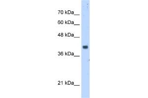 WB Suggested Anti-PDSS1 Antibody Titration:  5. (PDSS1 anticorps  (Middle Region))