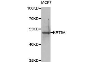 Western blot analysis of extracts of MCF7 cell line, using KRT6A antibody.