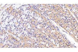 Detection of SLC in Porcine Stomach Tissue using Polyclonal Antibody to Secondary Lymphoid Tissue Chemokine (SLC)