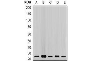 Western blot analysis of CHMP2B expression in MCF7 (A), LOVO (B), A549 (C), mouse lung (D), mouse kidney (E) whole cell lysates.