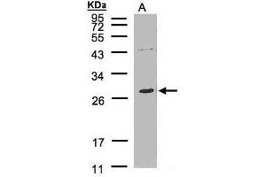 WB Image Sample(30 μg of whole cell lysate) A:Raji, 12% SDS PAGE antibody diluted at 1:500 (LAT2 anticorps  (C-Term))