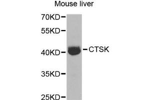 Western blot analysis of extracts of mouse liver, using CTSK antibody (ABIN5970899) at 1/1000 dilution. (Cathepsin K anticorps)