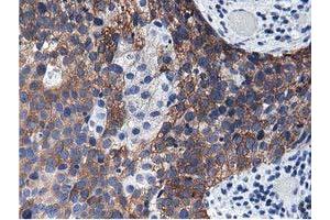Immunohistochemistry (IHC) image for anti-Aldehyde Dehydrogenase 1 Family, Member L1 (ALDH1L1) antibody (ABIN1496585) (ALDH1L1 anticorps)