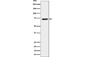 Western blot analysis of CTP synthase / CTPS expression in HeLa cell lysate.