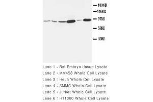 Image no. 1 for anti-Matrix Metallopeptidase 9 (Gelatinase B, 92kDa Gelatinase, 92kDa Type IV Collagenase) (MMP9) (AA 689-705) antibody (ABIN1493479) (MMP 9 anticorps  (AA 689-705))