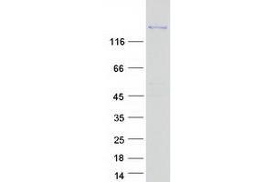 Validation with Western Blot