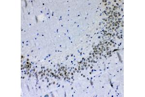 IHC analysis of PER1 using anti-PER1 antibody .