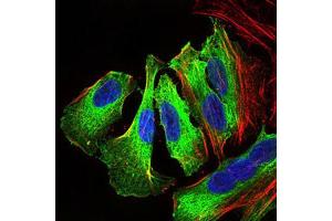 Immunocytochemistry (ICC) image for anti-Mitogen-Activated Protein Kinase 14 (MAPK14) (AA 299-360) antibody (ABIN1845584)