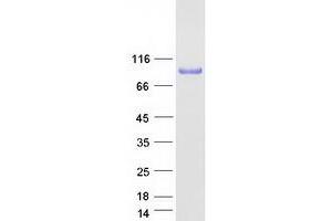 Validation with Western Blot