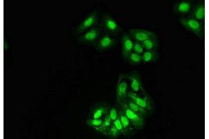 Immunofluorescent analysis of HepG2 cells using ABIN7155291 at dilution of 1:100 and Alexa Fluor 488-congugated AffiniPure Goat Anti-Rabbit IgG(H+L)
