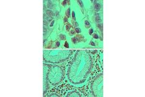 Caspase-3 Immunohistochemistry.
