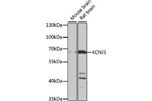 Western blot analysis of extracts of various cell lines, using KCNJ3 antibody (ABIN6134057, ABIN6142731, ABIN6142733 and ABIN6225132) at 1:1000 dilution.