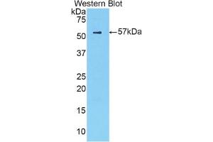 Western blot analysis of the recombinant protein. (CTSA anticorps  (AA 215-470))